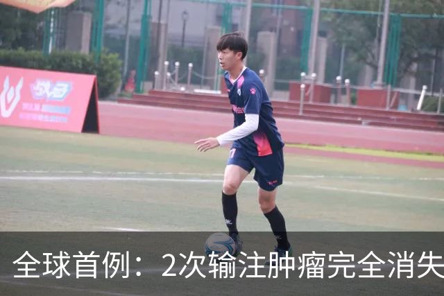 全球首例：2次输注肿瘤完全消失！新型CAR-T让肝癌实现12个月无癌